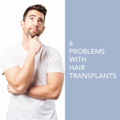 6 Problems with Hair Transplants