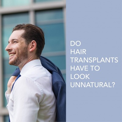 Do Hair Transplants Have to Look Unnatural?