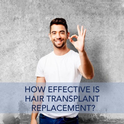 How Effective Is Hair Transplant Replacement?