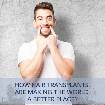 How Hair Transplants are Making the World a Better Place?
