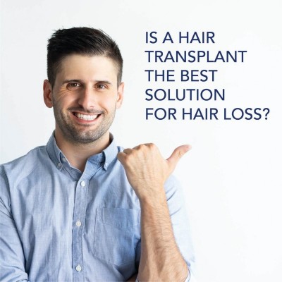 Is a Hair Transplant the Best Solution for Hair Loss?