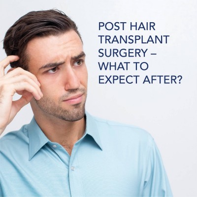 Post Hair Transplant Surgery – What to Expect After?